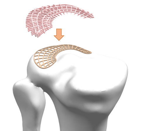 Biomimetic meniscus