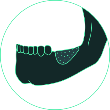 dental and oral rehabilitation design
