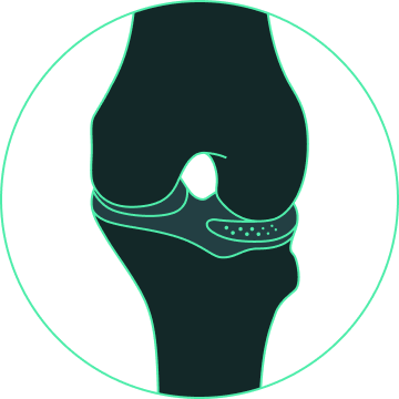 meniscus prosthesis design