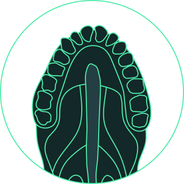 prosthesis design for palatal defects