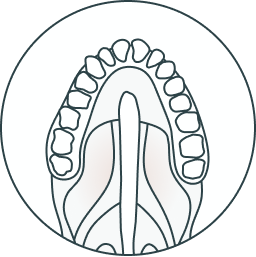 Palatal defects design